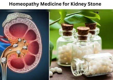 What symptoms of kidney stones can be treated at Dr. Kushwah’s Homoeopathic Clinic?
