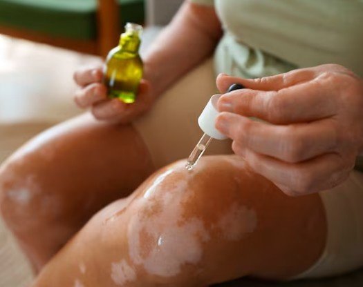 How Does Homeopathy Work for Chronic Skin Problems?