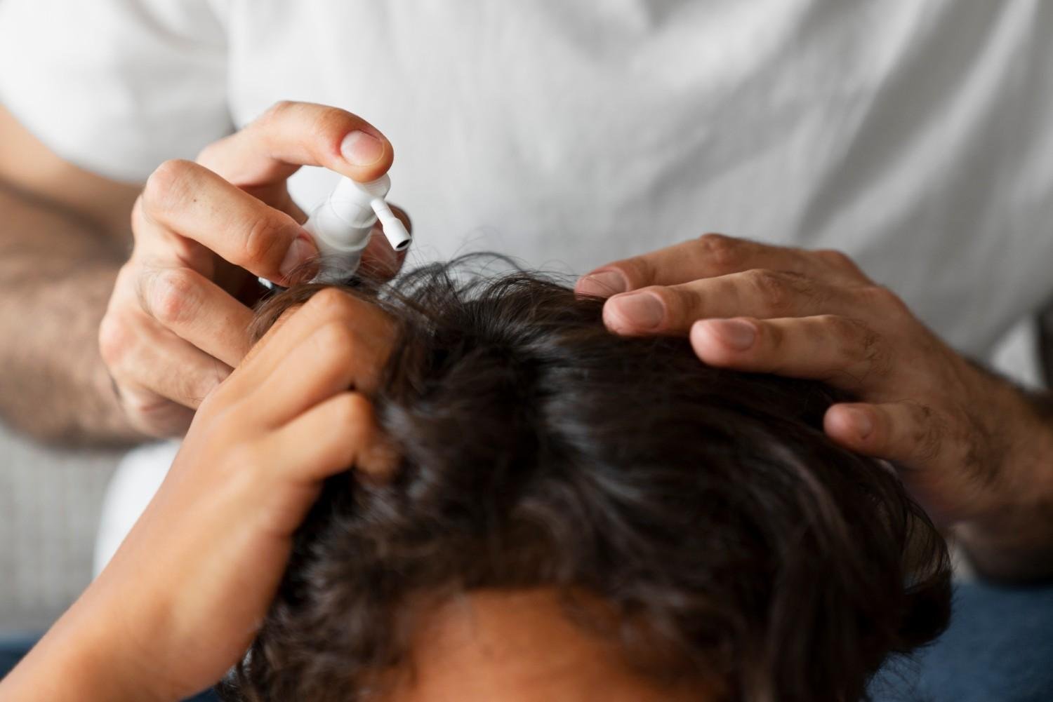 How Effective Is the Best Homeopathic Treatment for Hair Fall in Haryana for Long-Term Hair Growth?