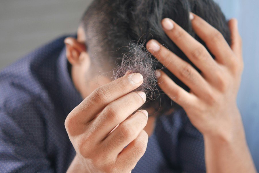 Early Warning Signs of Hair Fall You Should Never Ignore